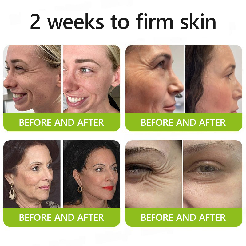 The (VIRAL) Vita A Retinal Cream