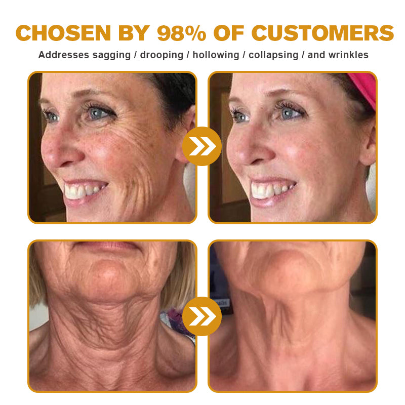 The (VIRAL) Bee Venom Wrinkle Cream